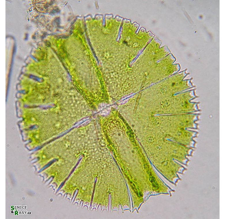 Micrasterias rotata