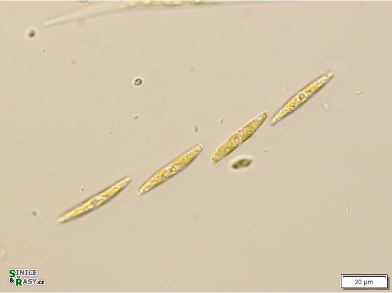 Elakatothrix genevensis