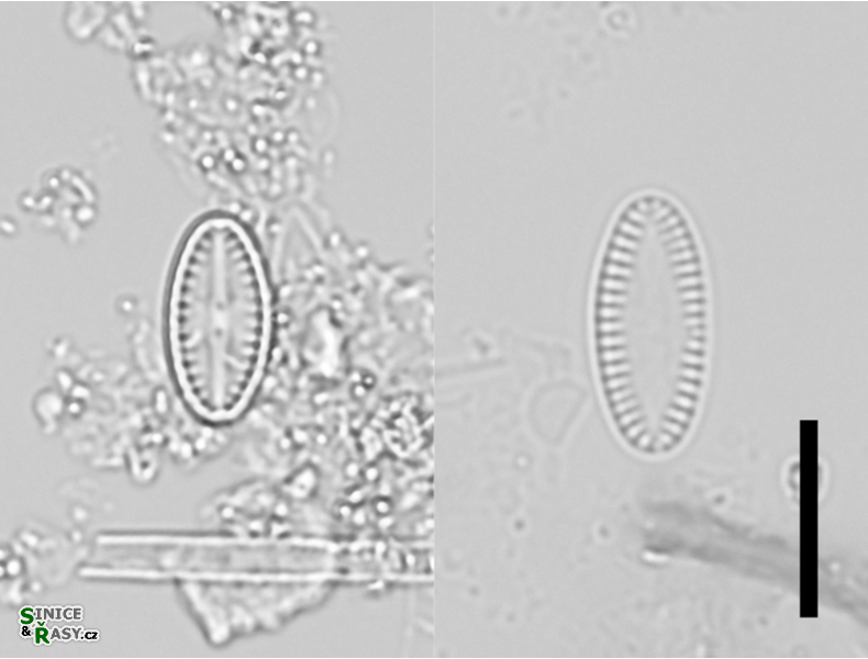 Platessa lutheri 