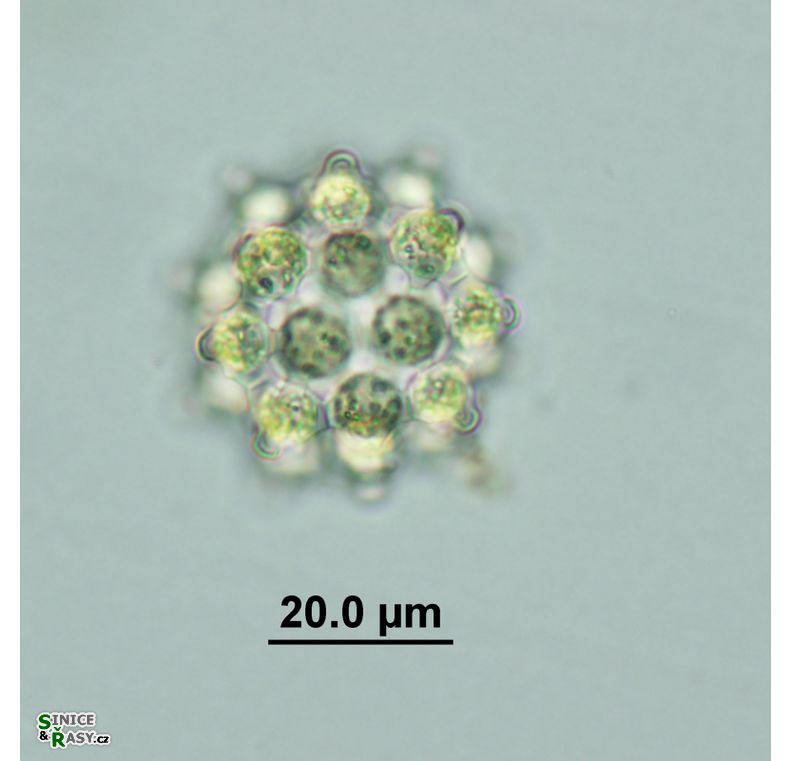 Coelastrum cambricum