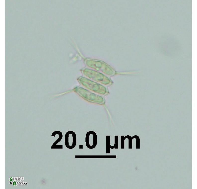 Desmodesmus armatus