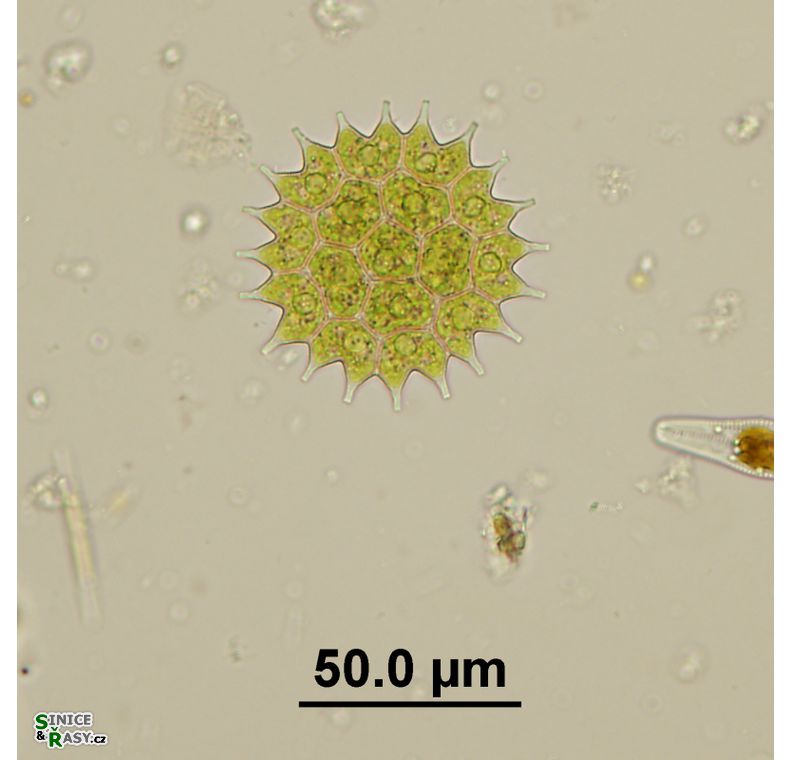 Pseudopediastrum boryanum