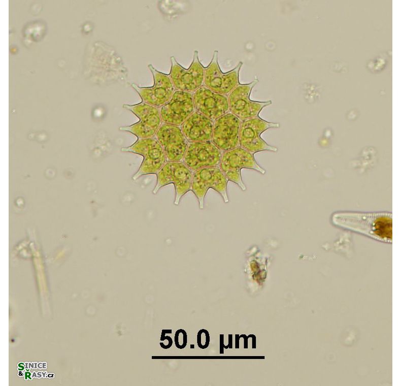 Pseudopediastrum boryanum