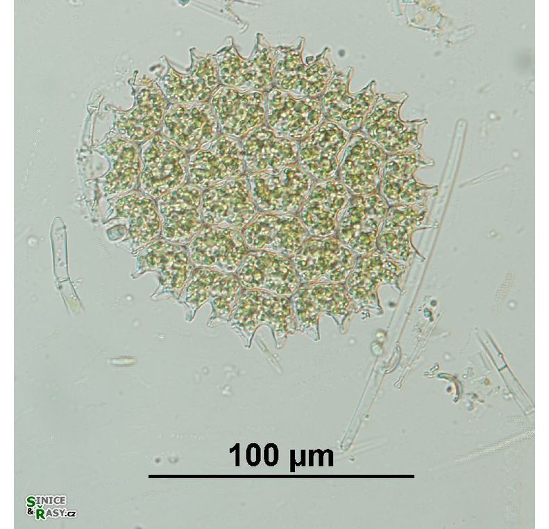 Pseudopediastrum boryanum