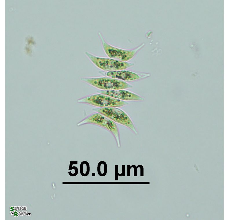 Tetradesmus lagerheimii