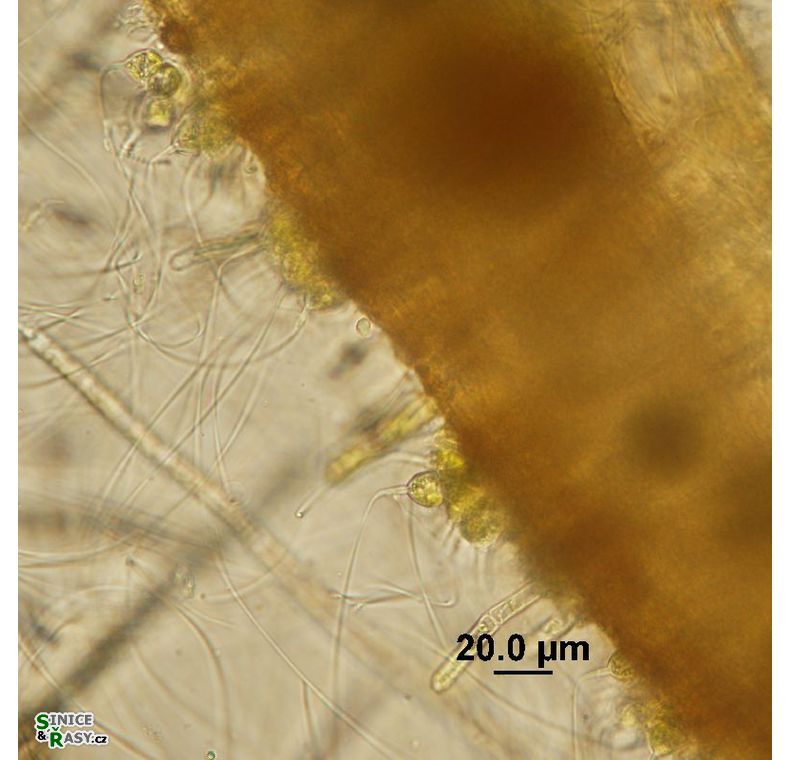 Aphanochaete sp.