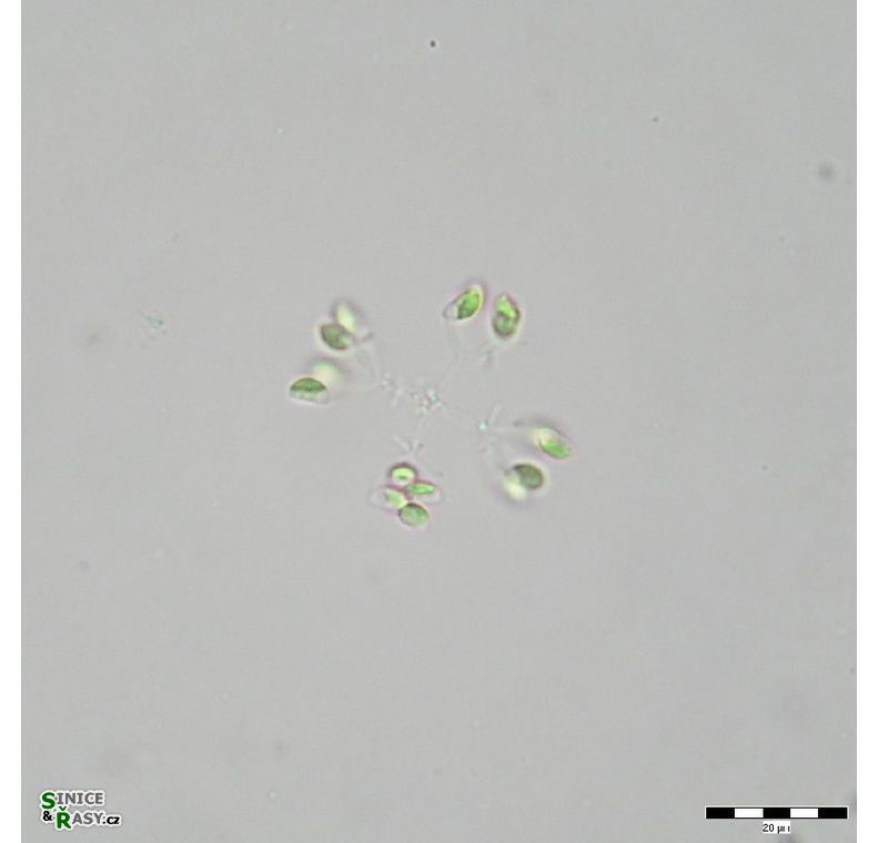Mucidosphaerium sphagnale