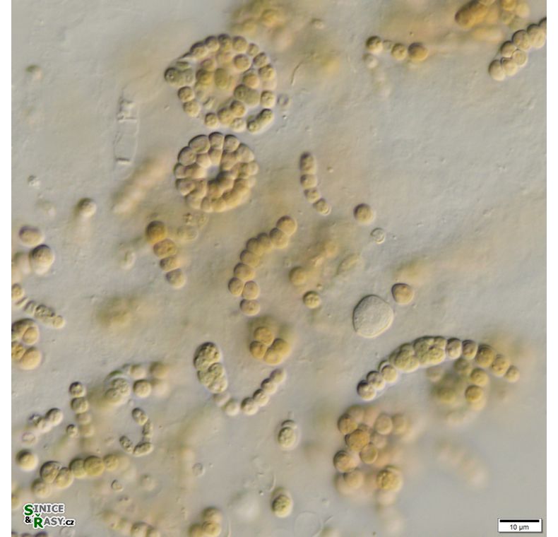 cf. Nostoc