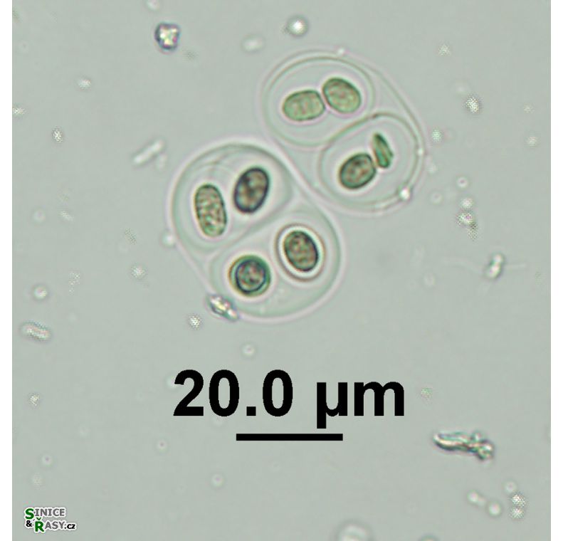 Gloeothce tepidariorum