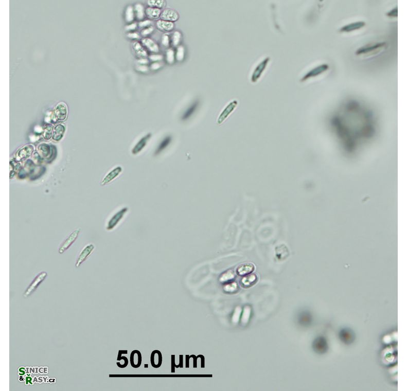 Elakatothrix genevensis