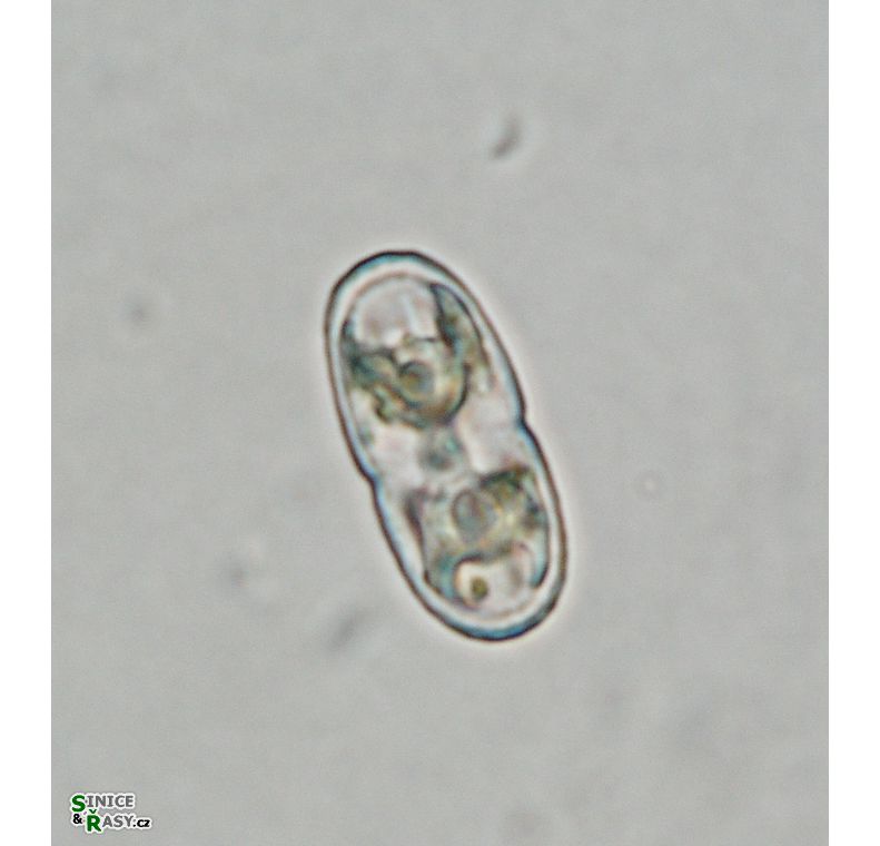 Actinotaenium kriegeri