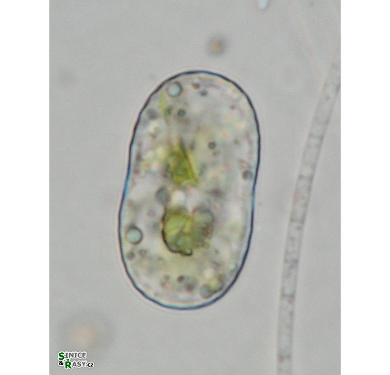 Actinotaenium trachypolum