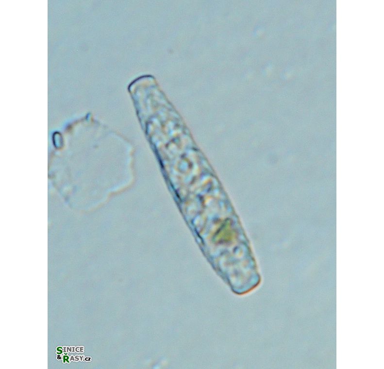 Gonatozygon brebissonii