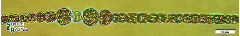 Sphaerospermopsis aphanizomenoides