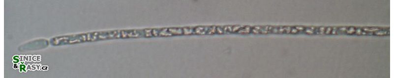 Cylindrospermopsis raciborskii
