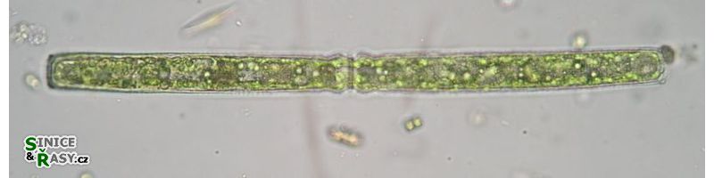 Pleurotaenium
