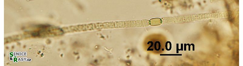 Anabaena cf. augstumalis