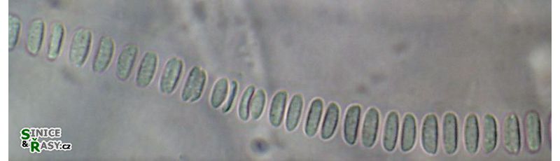 Johannesbaptistia sp.