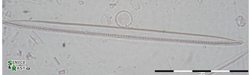 Nitzschia