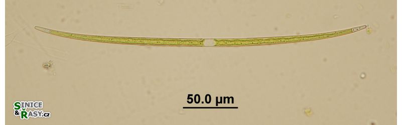 Closterium