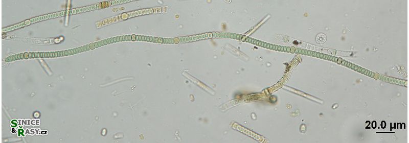 Nodularia harveyana