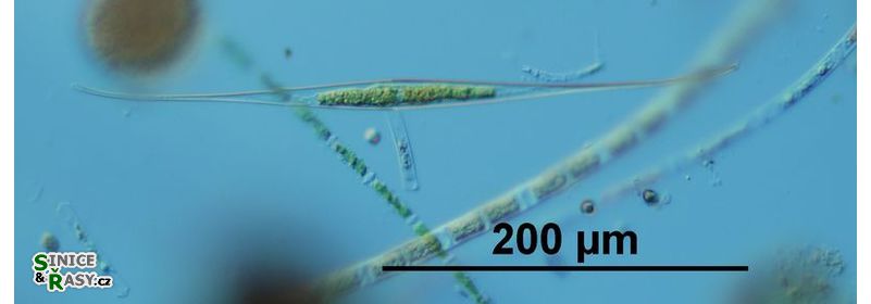 Closterium kuetzingii