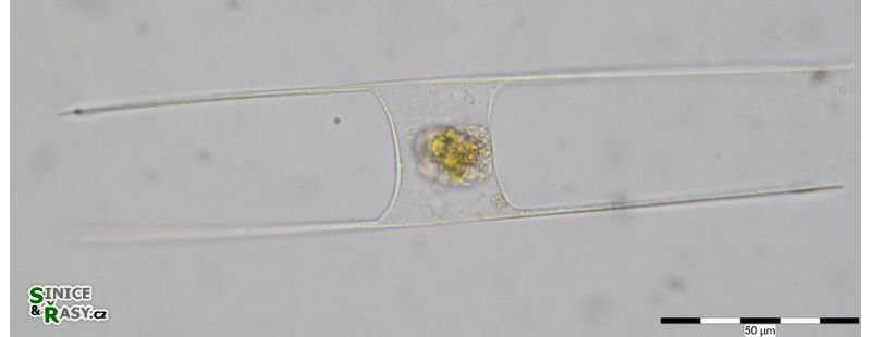 Hemiaulus hauckii