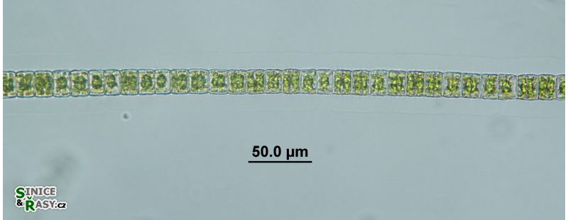Hyalotheca dissiliens