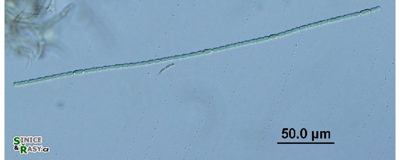 Anabaena augstumalis