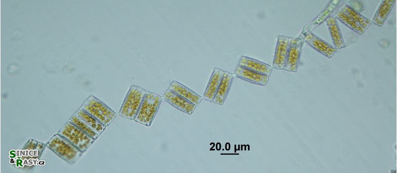 Diatoma vulgaris