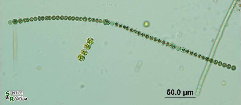 Dolichospermum