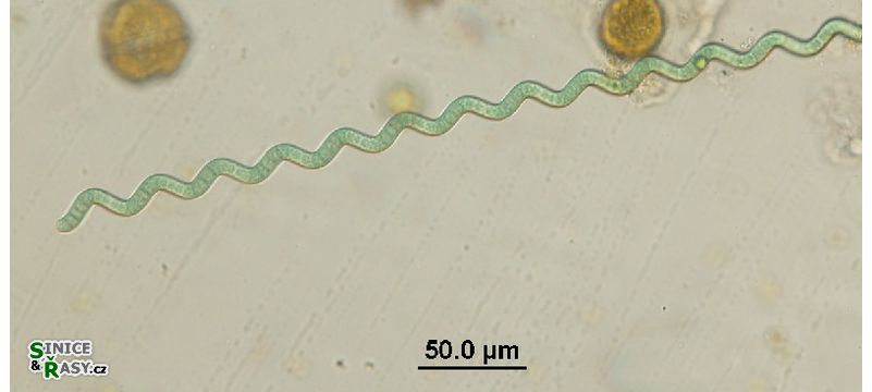 Arthrospira jenneri