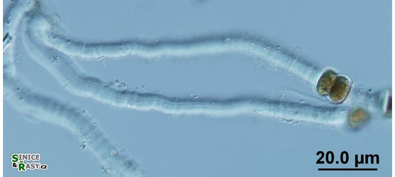Vincularia roraimae