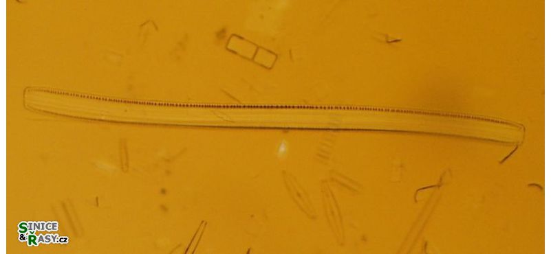 Nitzschia sigmoidea