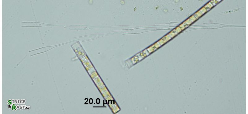Dinobryon bavaricum
