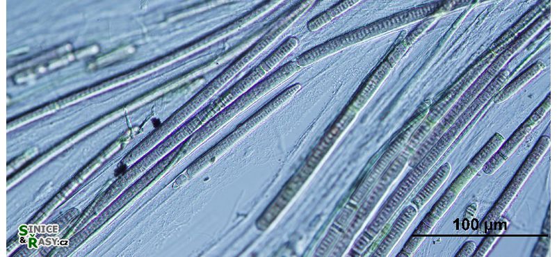 Phormidium subfuscum