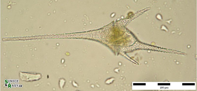 Ceratium hirundinella