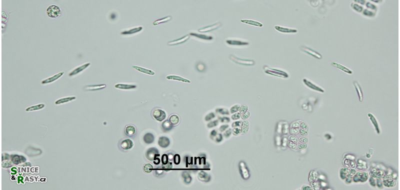 Elakatothrix genevensis