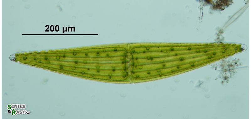 Closterium ehrenbergii