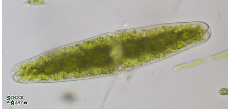 Tetmemorus granulatus