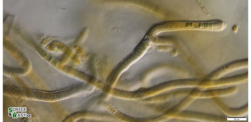 cf. Scytonematopsis