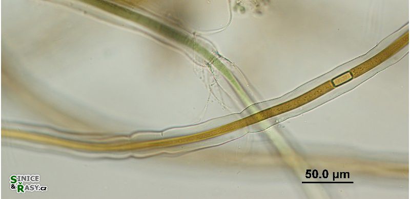 Scytonema cf. myochrous