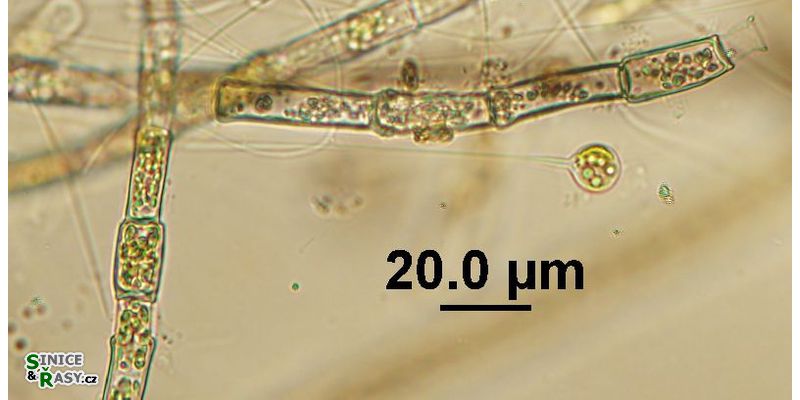 Aphanochaete sp.