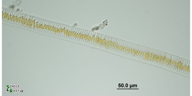Fragillaria