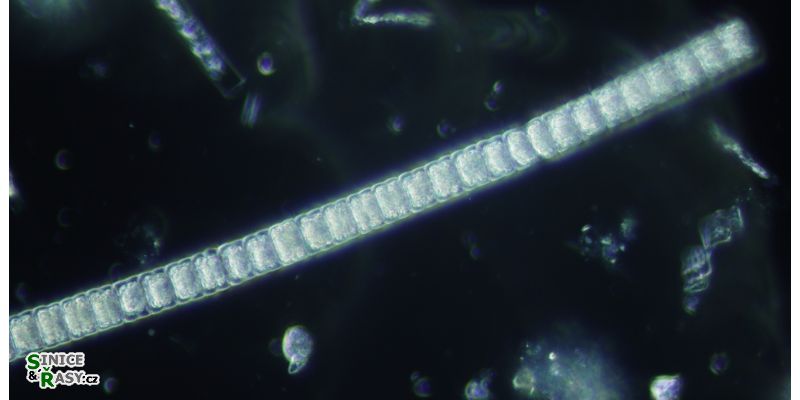 Hyalotheca dissiliens