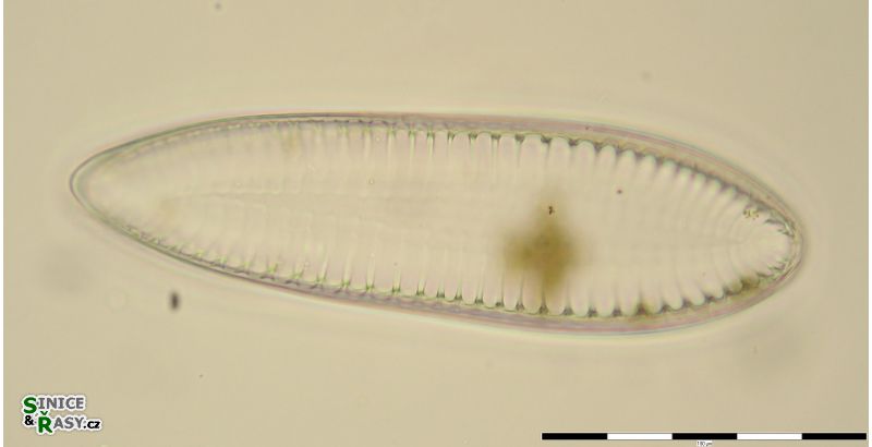 Surirella