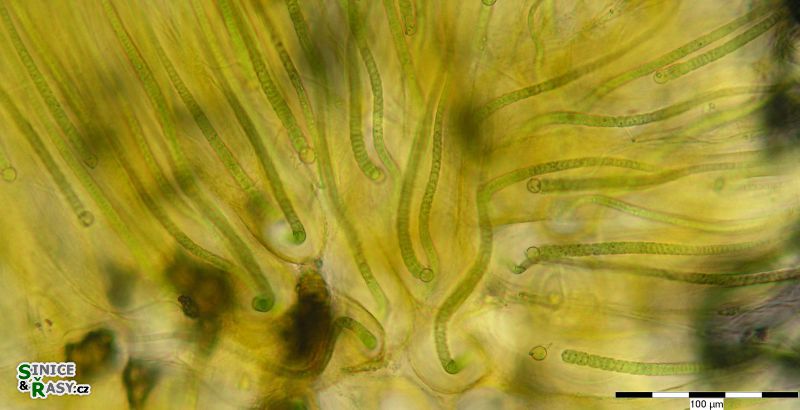 Rivularia mesenterica