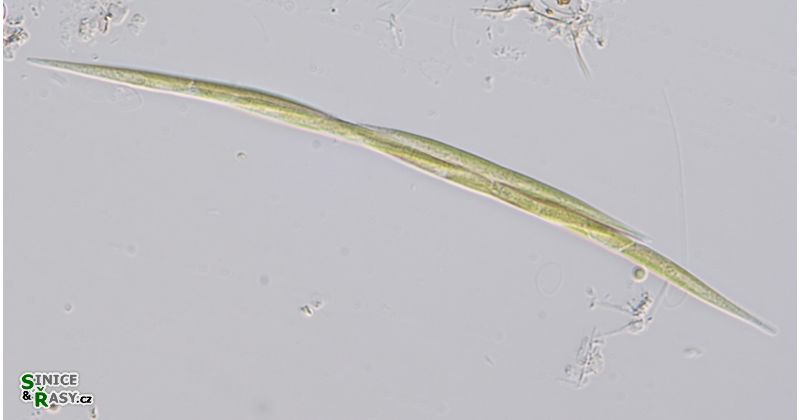 Monoraphidium griffithii