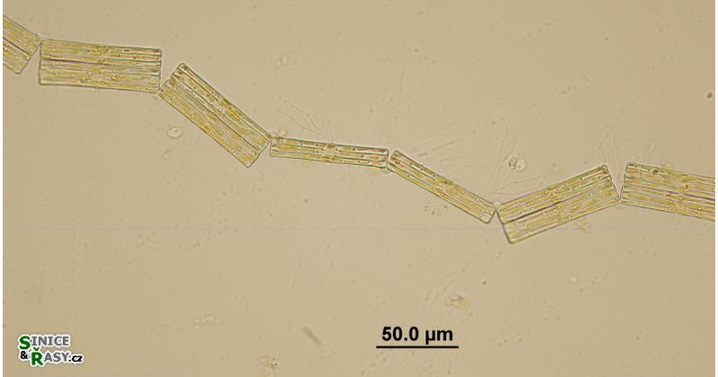 Tabellaria fenestrata
