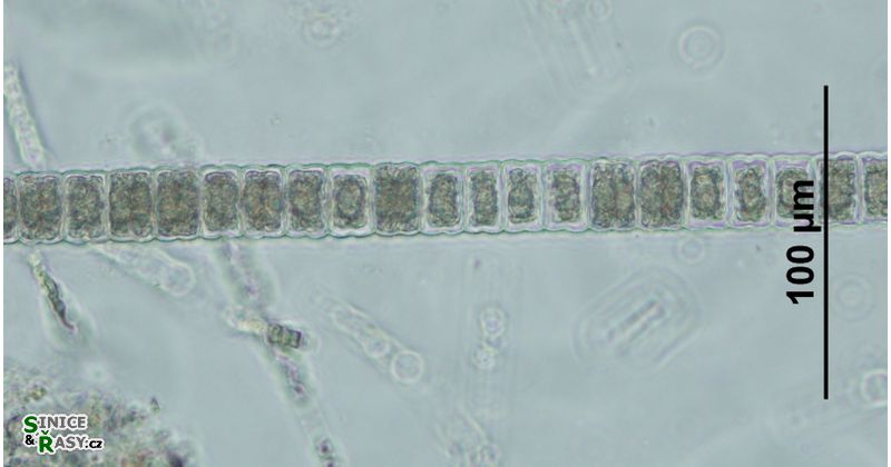 Hyalotheca dissiliens